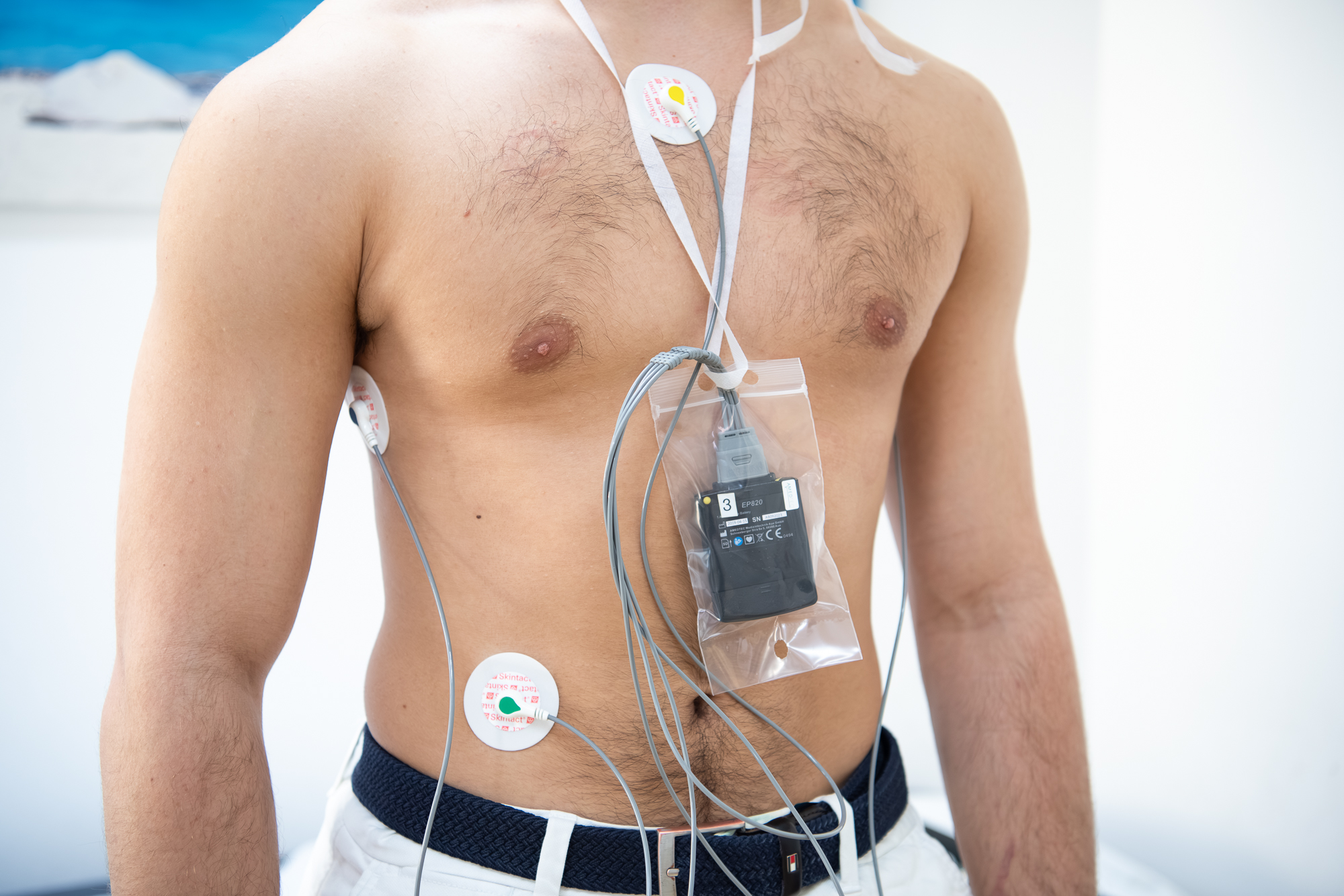 Oberkörper eines Patienten mit Langzeit-EKG (Holter)
