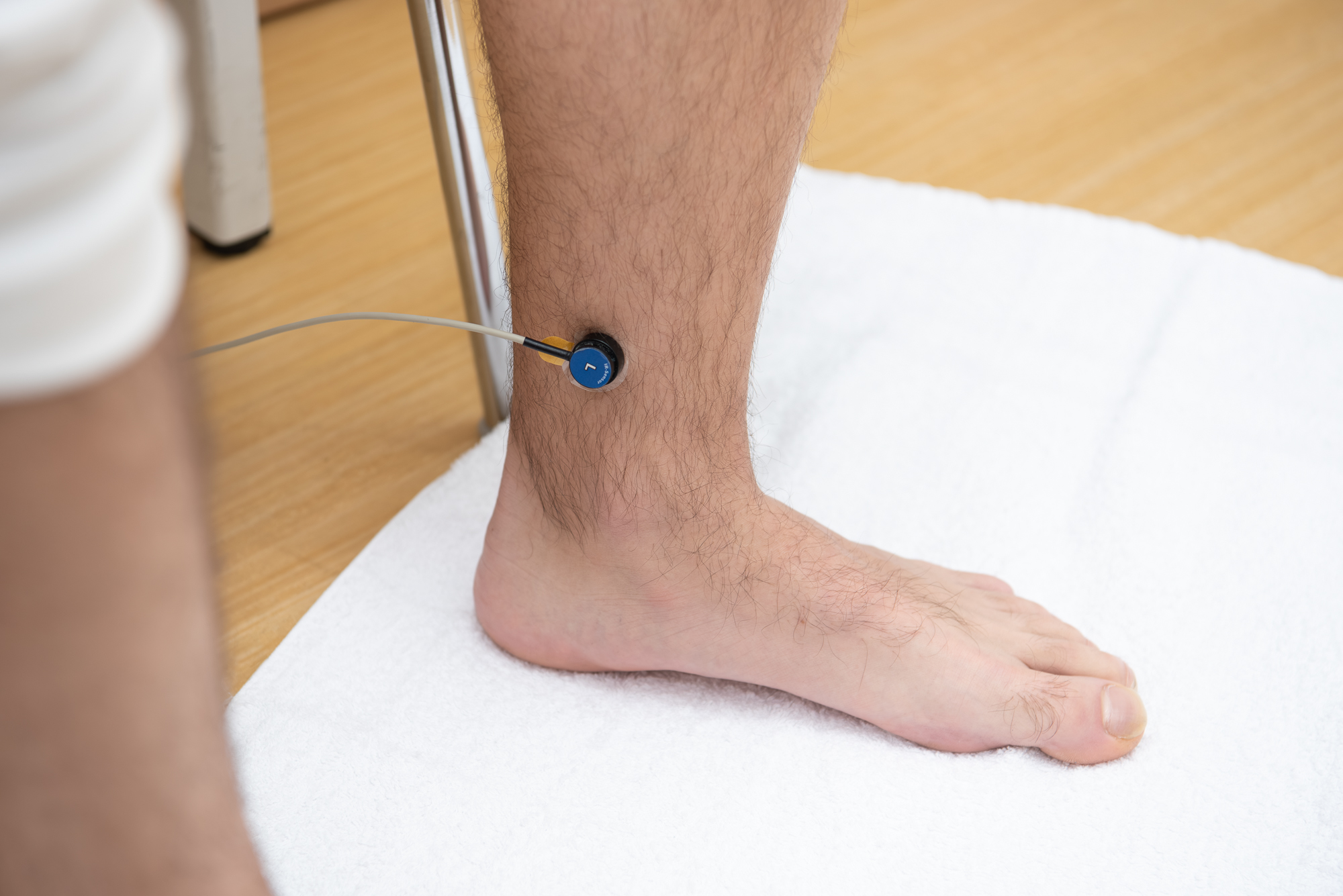 Fuß eines Patienten mit dem Sensor für die digitale Photoplethysmographie der Venen